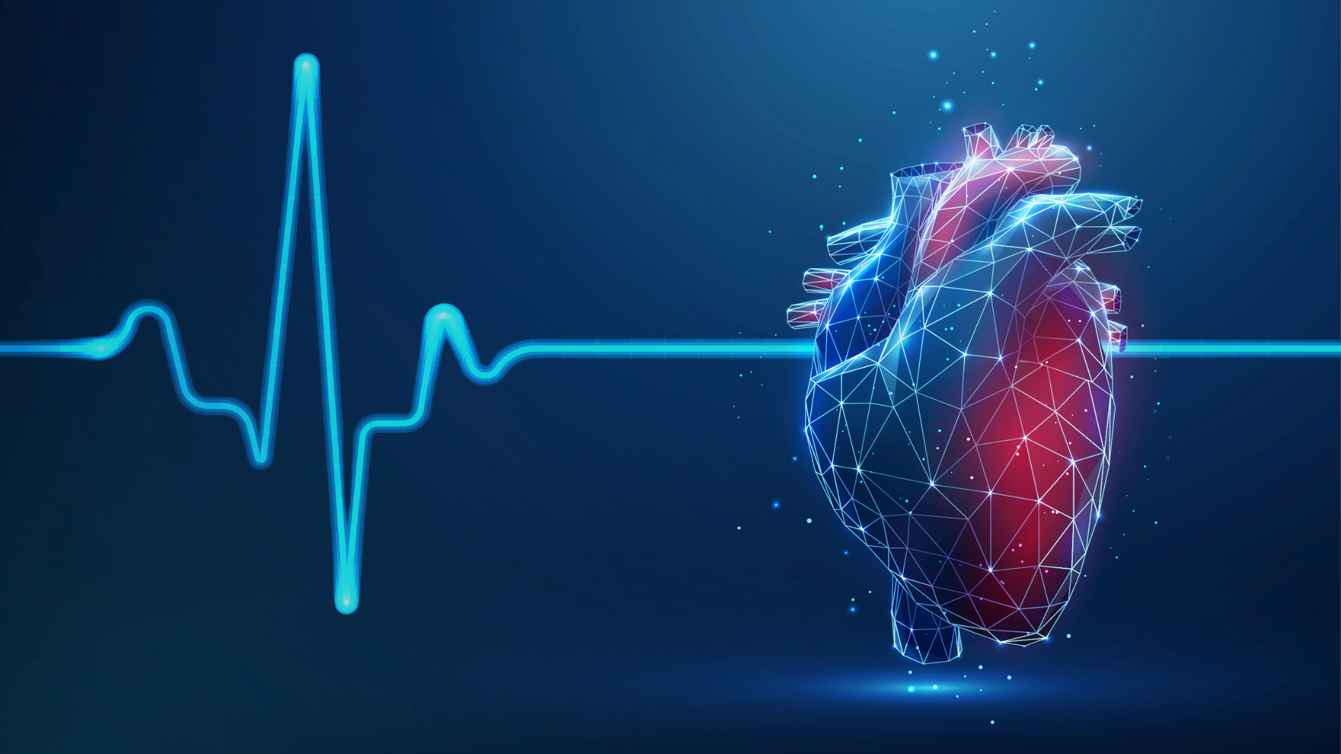 Cardio tech